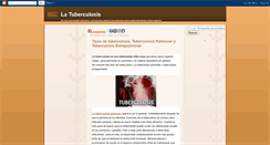 Desktop Screenshot of infotuberculosis.blogspot.com