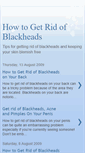 Mobile Screenshot of howtogetridofblackheadsfast.blogspot.com