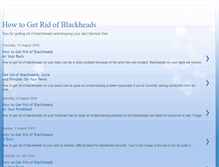 Tablet Screenshot of howtogetridofblackheadsfast.blogspot.com