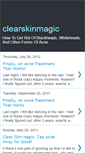 Mobile Screenshot of clearskinmagic.blogspot.com