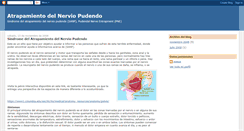 Desktop Screenshot of nerviopudendo.blogspot.com