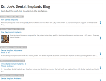 Tablet Screenshot of implantsdentist.blogspot.com