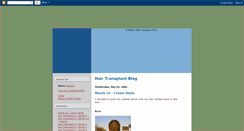 Desktop Screenshot of bobmans-hair-transplant.blogspot.com