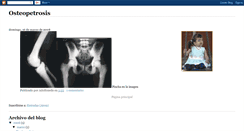 Desktop Screenshot of osteopetrosis2.blogspot.com