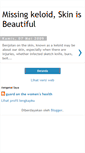 Mobile Screenshot of missing888.blogspot.com