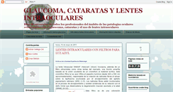 Desktop Screenshot of glaucomaycataratalentesintraoculares.blogspot.com