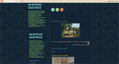 Desktop Screenshot of mi-bypass.blogspot.com