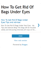 Mobile Screenshot of getridofbagsundereyes.blogspot.com
