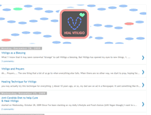 Tablet Screenshot of healvitiligo.blogspot.com