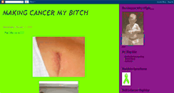 Desktop Screenshot of makingcancermybitch.blogspot.com