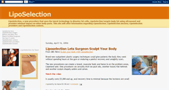 Desktop Screenshot of liposelection.blogspot.com