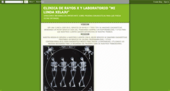 Desktop Screenshot of clinicaderayosxmilindaxelaju.blogspot.com