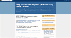 Desktop Screenshot of dentalimplantsonlongisland.blogspot.com