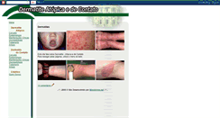 Desktop Screenshot of dermatites.blogspot.com