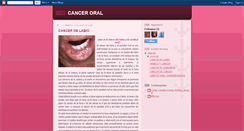 Desktop Screenshot of canceroralnoveno.blogspot.com