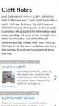 Mobile Screenshot of cleftnotes.blogspot.com