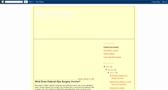 Desktop Screenshot of cataract-eye-surgery.blogspot.com