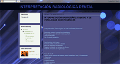 Desktop Screenshot of interpretacionradiologicadental.blogspot.com