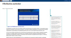 Desktop Screenshot of fibrilacionauricular.blogspot.com