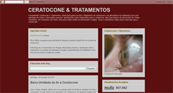 Desktop Screenshot of ceratocone-tratamentos.blogspot.com