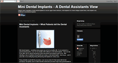 Desktop Screenshot of mini-dental-implants.blogspot.com