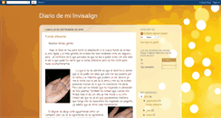 Desktop Screenshot of diarioinvisalignstx.blogspot.com