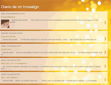 Tablet Screenshot of diarioinvisalignstx.blogspot.com