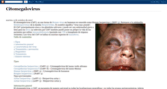 Desktop Screenshot of citomegalovirus.blogspot.com