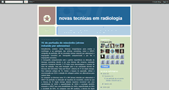 Desktop Screenshot of novastecnicasemradiologia.blogspot.com