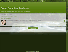 Tablet Screenshot of comocurarlosacufenos.blogspot.com