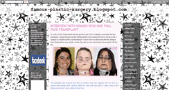 Desktop Screenshot of famous-plastic-surgery.blogspot.com