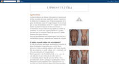 Desktop Screenshot of doctoramo-lipoescultura.blogspot.com