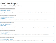 Tablet Screenshot of kevinsjawsurgery.blogspot.com