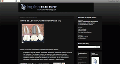 Desktop Screenshot of implantesdentales-co.blogspot.com