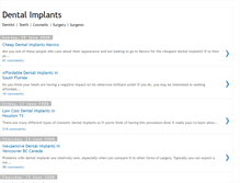 Tablet Screenshot of dentalimplantadvisor.blogspot.com