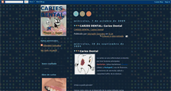 Desktop Screenshot of cariesdental-glori.blogspot.com