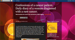 Desktop Screenshot of confessionsofacancerpatient.blogspot.com