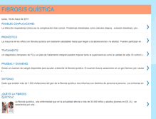 Tablet Screenshot of fibquistica.blogspot.com