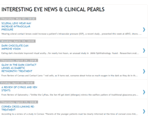 Tablet Screenshot of interestingeyenews.blogspot.com