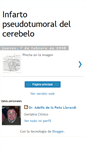 Mobile Screenshot of infartocerebeloso.blogspot.com