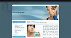 Desktop Screenshot of dentalimplantsnew.blogspot.com
