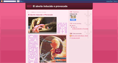 Desktop Screenshot of mjcbabortoinducido.blogspot.com