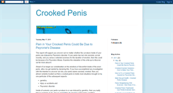 Desktop Screenshot of crookedpenis.blogspot.com