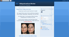 Desktop Screenshot of myacnefreein3daysreview.blogspot.com