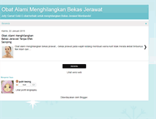 Tablet Screenshot of obatalamimenghilangkanbekasjerawat.blogspot.com