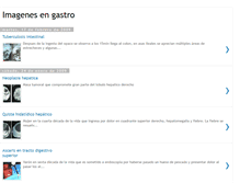 Tablet Screenshot of hnsebimagenes.blogspot.com