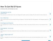 Tablet Screenshot of howtogetridofhyves.blogspot.com